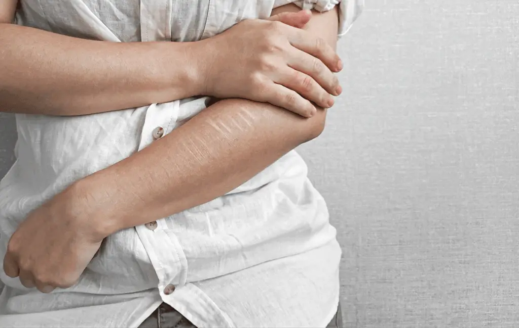 a teen shows signs of self harm to show what to do if your teen is cutting